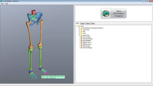 BoneLab - Image 3